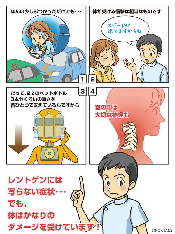 交通事故で受けるダメージ漫画