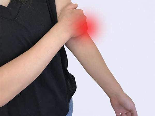 肘が痛い画像
